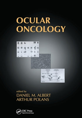 Ocular Oncology by Albert, Daniel M.