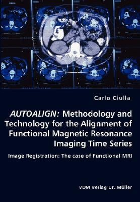 Autoalign: Methodology and Technology for the Alignment of Functional Magnetic Resonance Imaging Time Series by Ciulla, Carlo