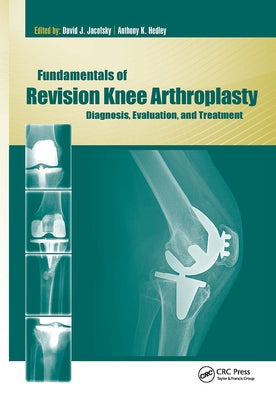 Fundamentals of Revision Knee Arthroplasty: Diagnosis, Evaluation, and Treatment by Jacofsky, David