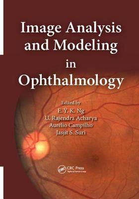 Image Analysis and Modeling in Ophthalmology by Ng, Eddie Y. K.
