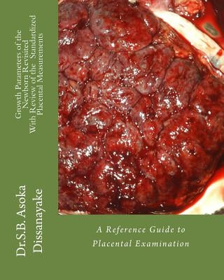 Growth arameters of the Newborn Revisited With Review of the Standardized Placental Measurements: A Reference Guide to Placental Examination by Dissanayake Mbbs, S. B. Asoka