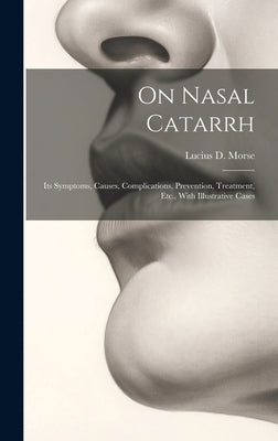 On Nasal Catarrh: Its Symptoms, Causes, Complications, Prevention, Treatment, Etc., With Illustrative Cases by Morse, Lucius D.