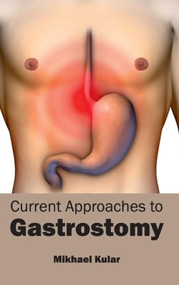 Current Approaches to Gastrostomy by Kular, Mikhael