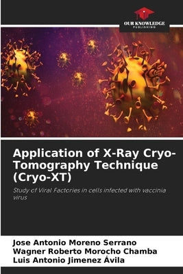 Application of X-Ray Cryo-Tomography Technique (Cryo-XT) by Moreno Serrano, Jose Antonio