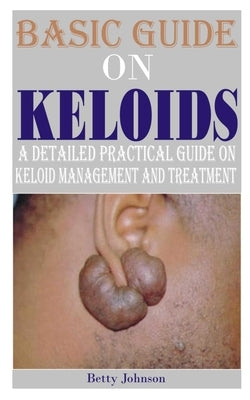 Basic Guide on Keloids: A detailed practical guide on keloid management and treatment by Johnson, Betty