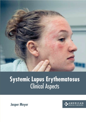 Systemic Lupus Erythematosus: Clinical Aspects by Meyer, Jasper