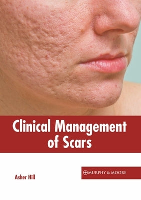 Clinical Management of Scars by Hill, Asher