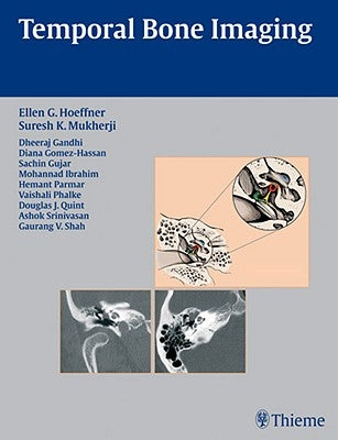 Temporal Bone Imaging by Hoeffner, Ellen G.