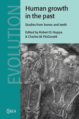 Human Growth in the Past: Studies from Bones and Teeth by Hoppa, Robert D.