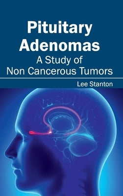Pituitary Adenomas: A Study of Non Cancerous Tumors by Stanton, Lee