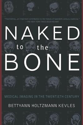 Naked to the Bone: Medical Imaging in the Twentieth Century by Kevles, Bettyann Holtzmann