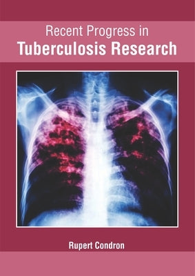 Recent Progress in Tuberculosis Research by Condron, Rupert