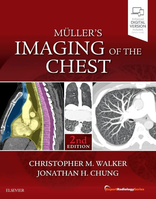 Muller's Imaging of the Chest: Expert Radiology Series by Walker, Christopher M.