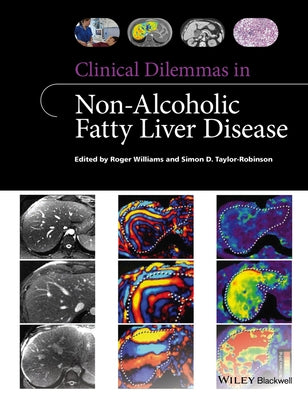 Clinical Dilemmas in Non-Alcoholic Fatty Liver Disease by Williams, Roger