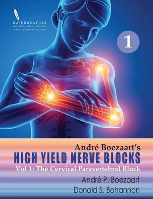 High Yield Nerve Blocks Vol 1: The Cervical Paravertebral Block by Bohannon, Donald S.