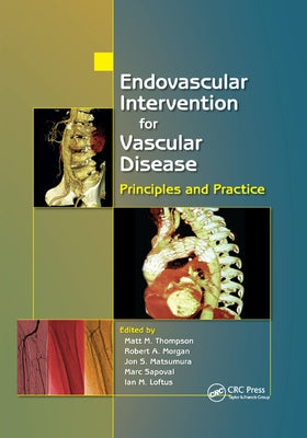 Endovascular Intervention for Vascular Disease: Principles and Practice by Thompson, Matt M.