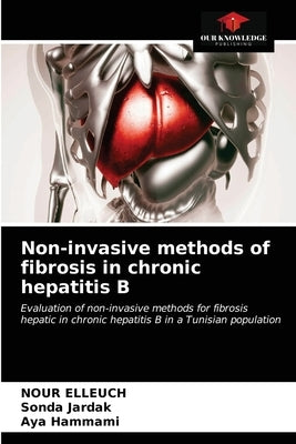 Non-invasive methods of fibrosis in chronic hepatitis B by Elleuch, Nour