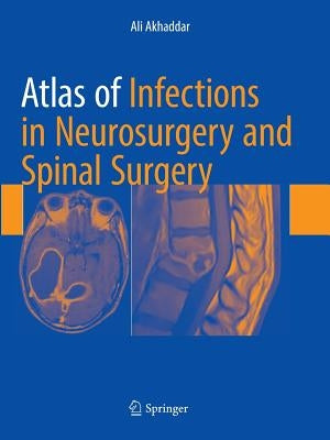 Atlas of Infections in Neurosurgery and Spinal Surgery by Akhaddar, Ali