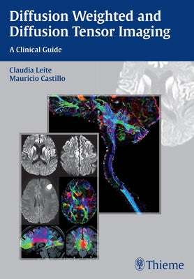 Diffusion Weighted and Diffusion Tensor Imaging: A Clinical Guide by Leite, Claudia