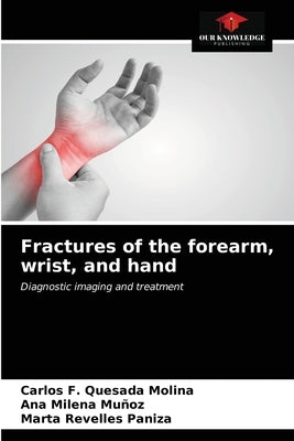 Fractures of the forearm, wrist, and hand by Quesada Molina, Carlos F.