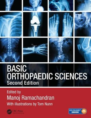 Basic Orthopaedic Sciences by Ramachandran, Manoj