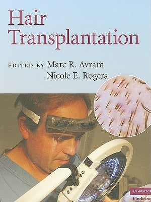 Hair Transplantation by Avram, Marc R.