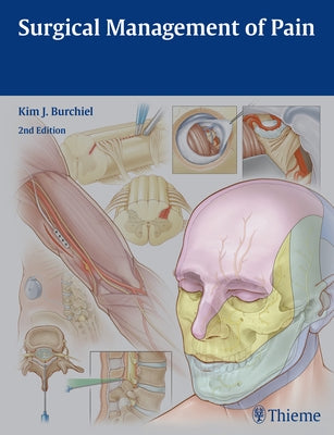 Surgical Management of Pain by Burchiel, Kim J.