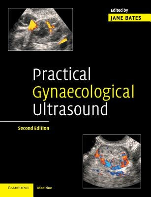 Practical Gynaecological Ultrasound by Bates, Jane