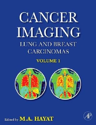 Cancer Imaging: Lung and Breast Carcinomas by Hayat, M. A.