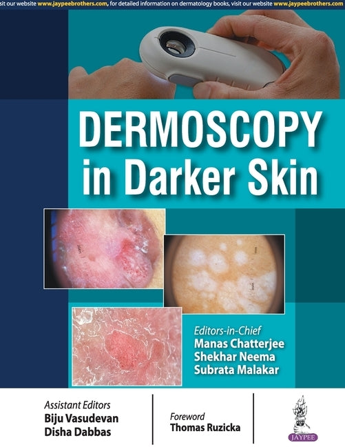 Dermoscopy in Darker Skin by Chatterjee, Manas