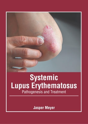 Systemic Lupus Erythematosus: Pathogenesis and Treatment by Meyer, Jasper