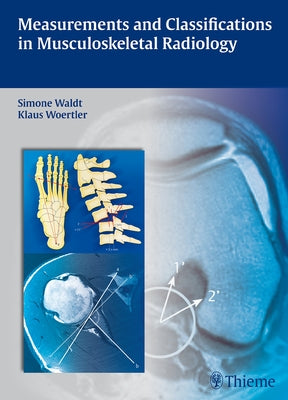 Measurements and Classifications in Musculoskeletal Radiology by Waldt, Simone