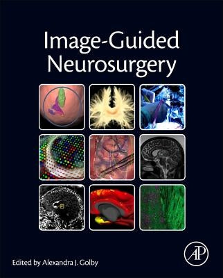 Image-Guided Neurosurgery by Golby, Alexandra J.