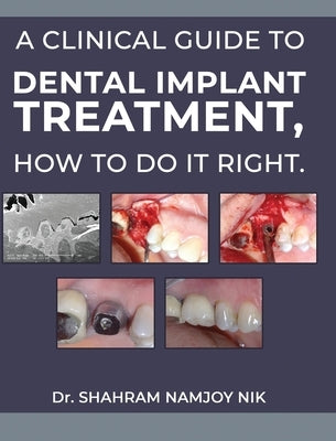 A clinical guide to dental implant treatment, how to do it right. by Namjoy Nik, Shahram