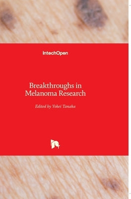 Breakthroughs in Melanoma Research by Tanaka, Yohei