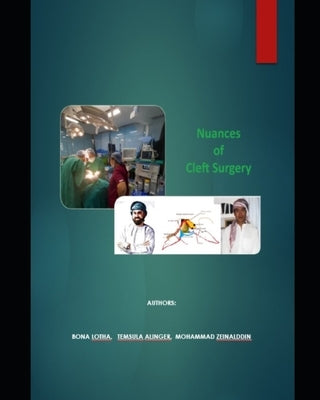 Nuances of cleft surgery by Alinger, Temsula