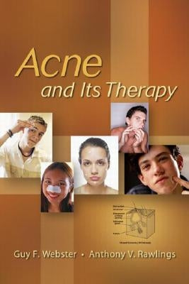 Acne and Its Therapy by Webster, Guy F.