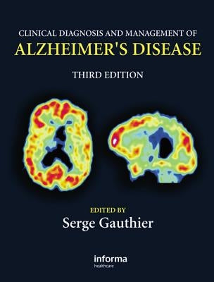 Clinical Diagnosis and Management of Alzheimer's Disease by Gauthier, Serge