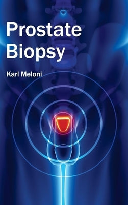 Prostate Biopsy by Meloni, Karl