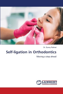 Self-ligation in Orthodontics by Rathod, Sunny