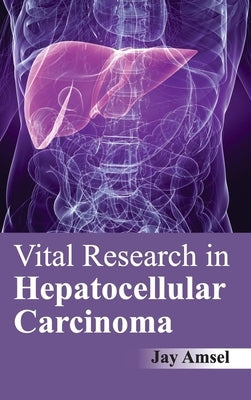 Vital Research in Hepatocellular Carcinoma by Amsel, Jay
