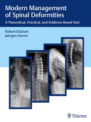 Modern Management of Spinal Deformities: A Theoretical, Practical, and Evidence-Based Text by Dickson, Robert a.