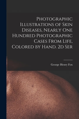 Photographic Illustrations of Skin Diseases, Nearly One Hundred Photographic Cases From Life, Colored by Hand. 2d Ser by Fox, George Henry 1846-1937