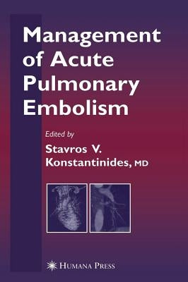 Management of Acute Pulmonary Embolism by Goldhaber, S. Z.