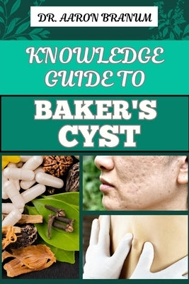 Knowledge Guide to Baker's Cyst: Essential Manual To Symptoms, Diagnosis, Treatment Options, And Prevention For Optimal Knee Health by Branum, Aaron