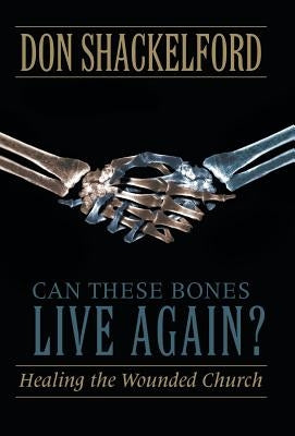 Can These Bones Live Again?: Healing the Wounded Church by Shackelford, Don