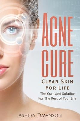 Acne Cure Clear Skin For Life by Dawnson, Ashley