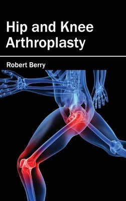 Hip and Knee Arthroplasty by Berry, Robert