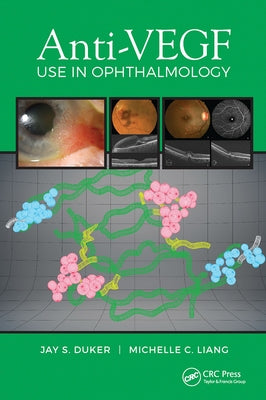 Anti-VEGF Use in Ophthalmology by Duker, Jay