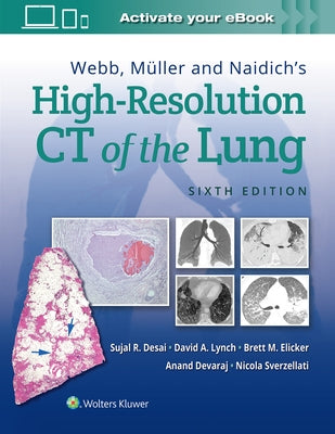 Webb, Müller and Naidich's High-Resolution CT of the Lung by Desai, Sujal